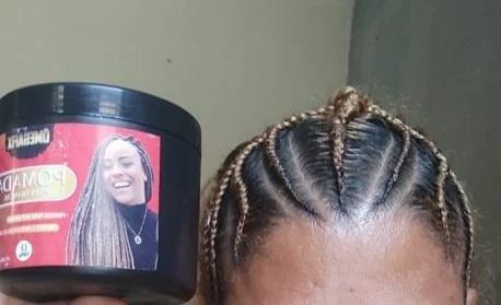 Intoxicação por uso de pomada modeladora de cabelo cresce na Bahia.