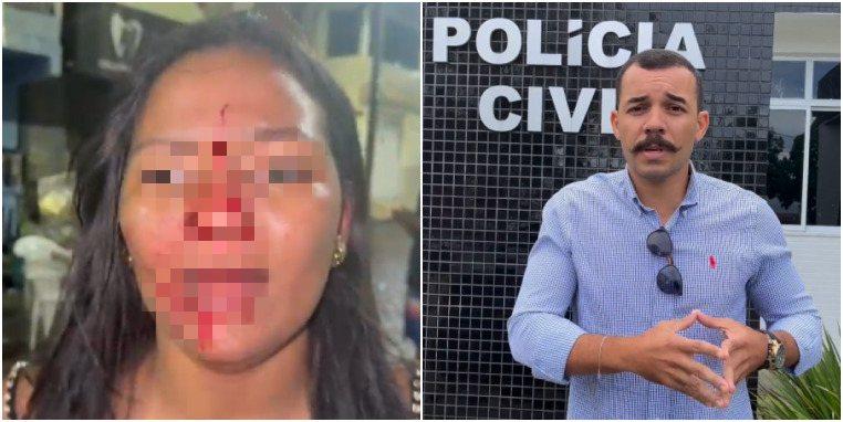 Candidato a vereador de Itapicuru e namorada são acusados de agredir três mulheres.